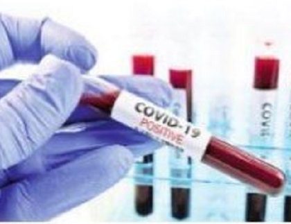 విస్తృత పరీక్షలే రక్ష